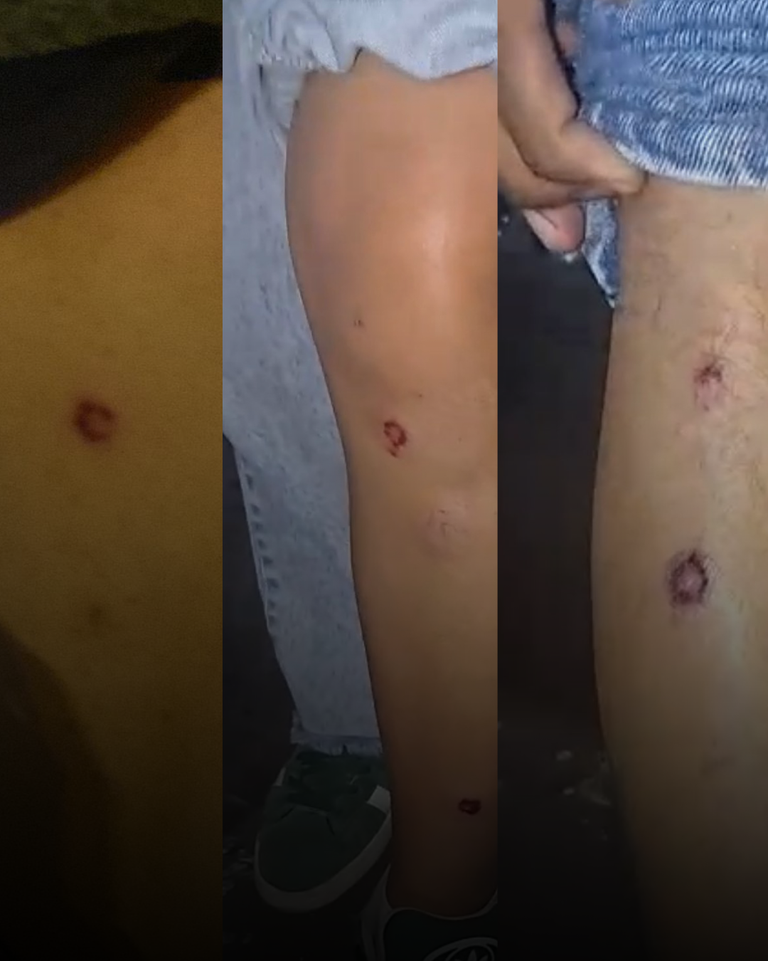 Perú: policía dispara perdigones contra periodistas durante protesta social